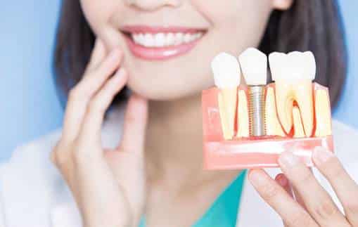 dental implants Sioux Falls