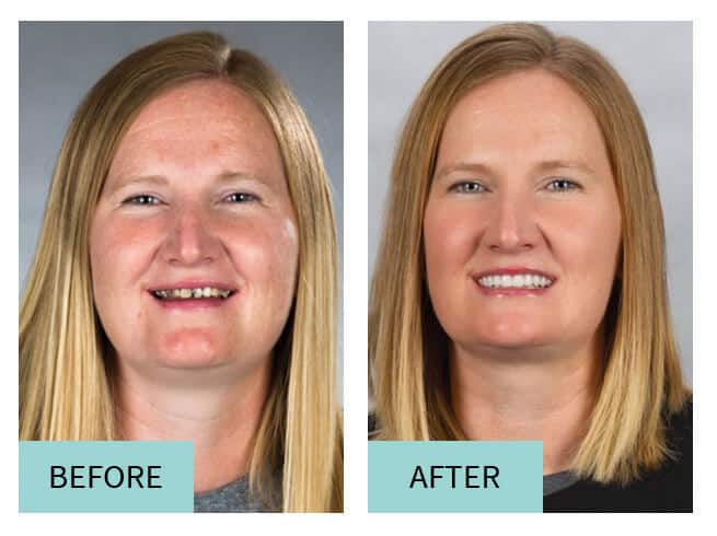 Cosmetic Dentist Sioux Falls