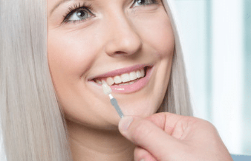 is dental veneers right for you