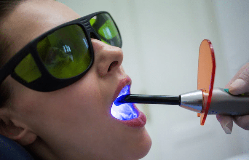 laser tretment for gum diseases