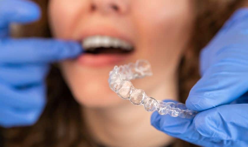 Invisalign Treatment Sioux Falls - Designer Dentistry