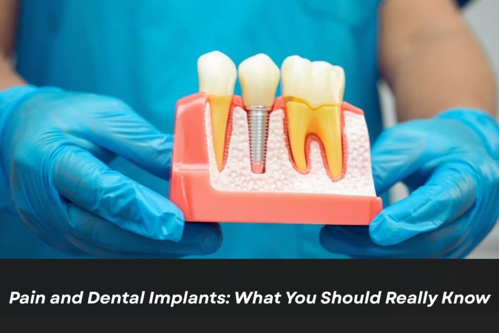 Pain and Dental Implants