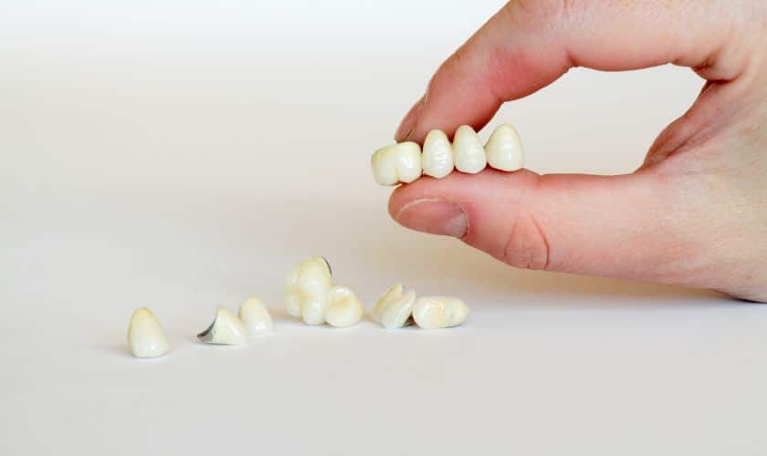 Are Porcelain Crowns Right Choice for Your Dental Needs