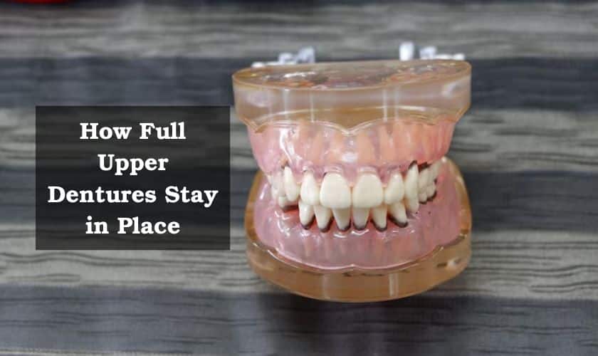 How Do Full Upper Dentures Stay in Place