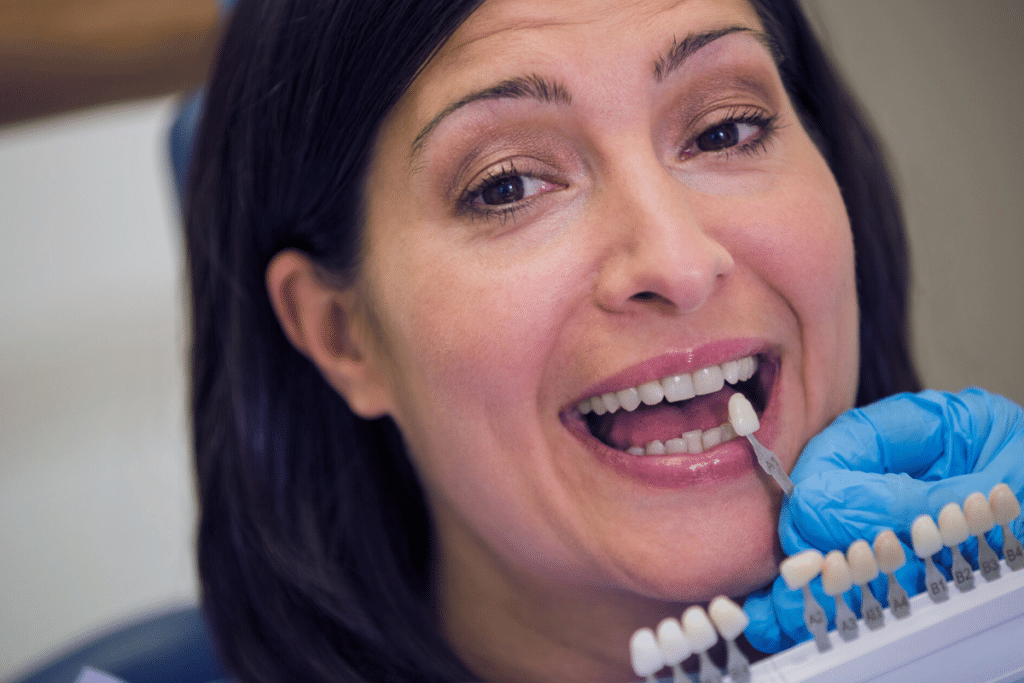 Can Dental Veneers Fix Gaps Between Teeth