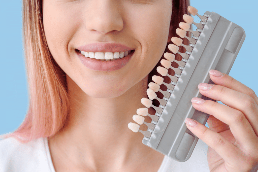Veneers Sioux Falls