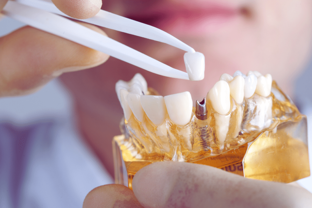 implant dentist sioux falls