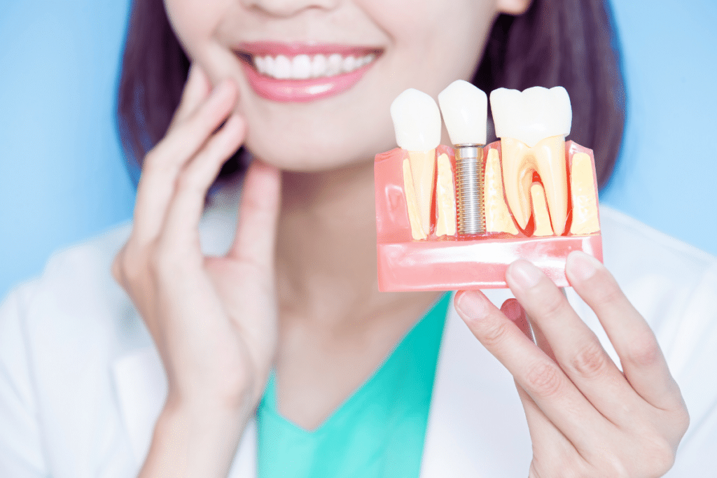 6 Things to Monitor After Implant Surgery