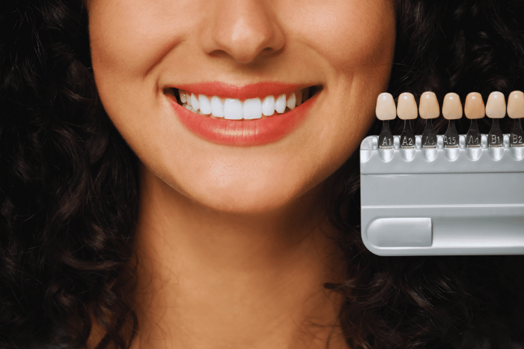 Why Is Transforming Your Smile With Veneers Worth It