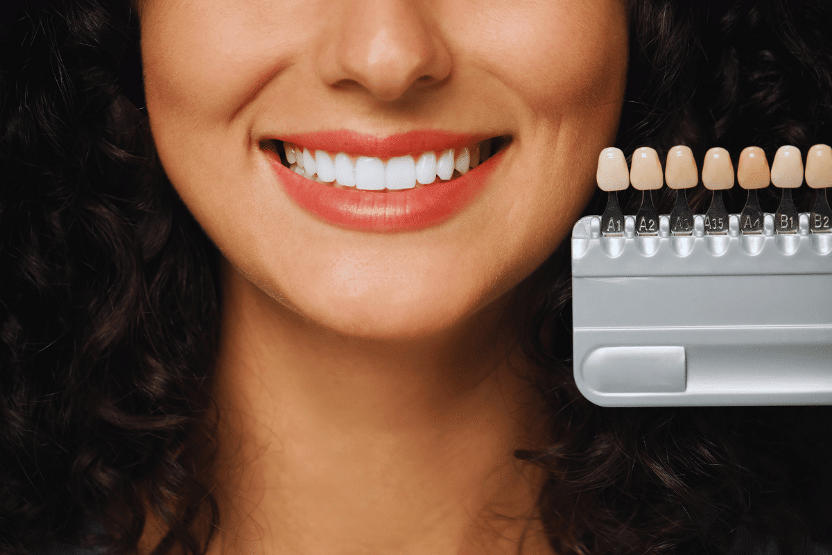 Why Is Transforming Your Smile With Veneers Worth It