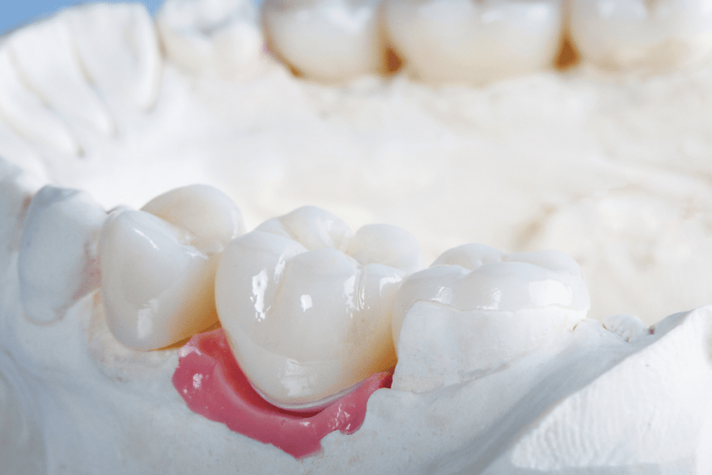 How Cold Affects Your Dental Crowns