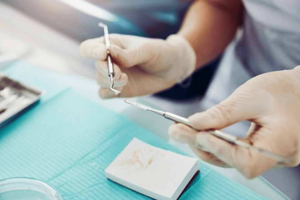 What Factors Affect Mercury-Free Filling Durability?