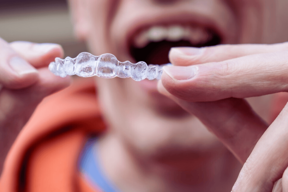 Common Reasons Why Your Invisalign Isn’t Working