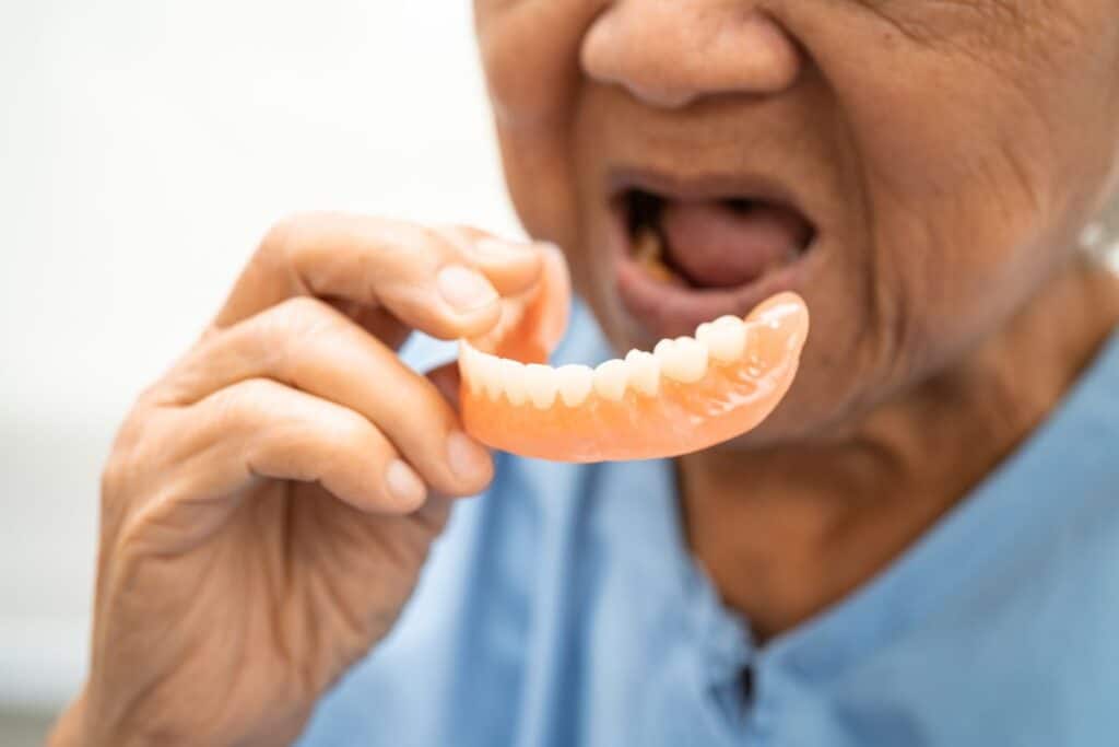 do-it-yourself-dentures-sioux-falls