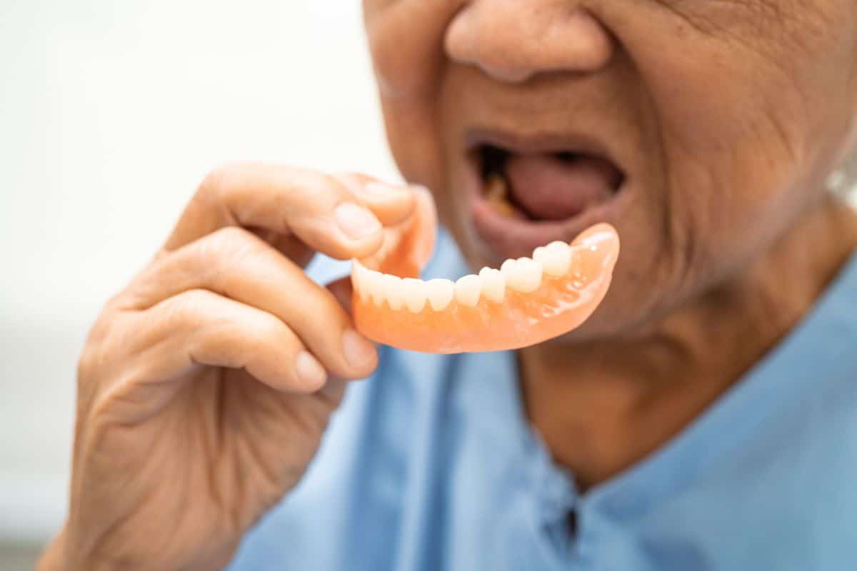 do-it-yourself-dentures-sioux-falls