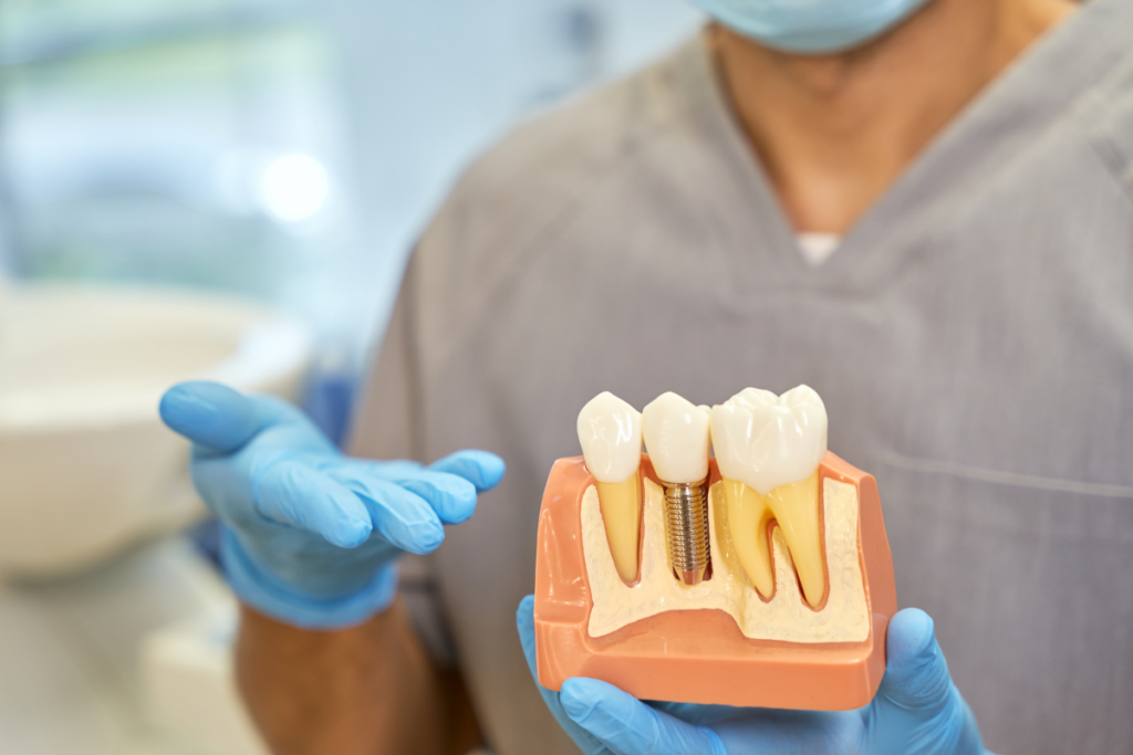 Can You Get An MRI With Dental Implants