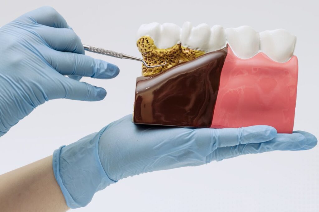 Why Preventive Dental Visits Are Important for Sioux Falls Residents