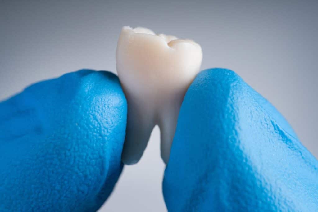 Early Signs of Enamel Erosion