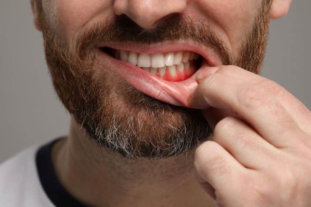 Why gum health is as important as tooth health